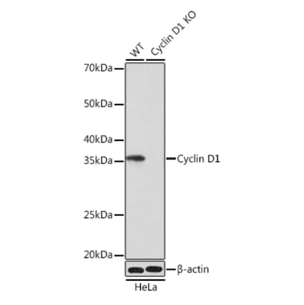 Western Blot - Anti-Cyclin D1 Antibody [ARC0300] (A306339) - Antibodies.com