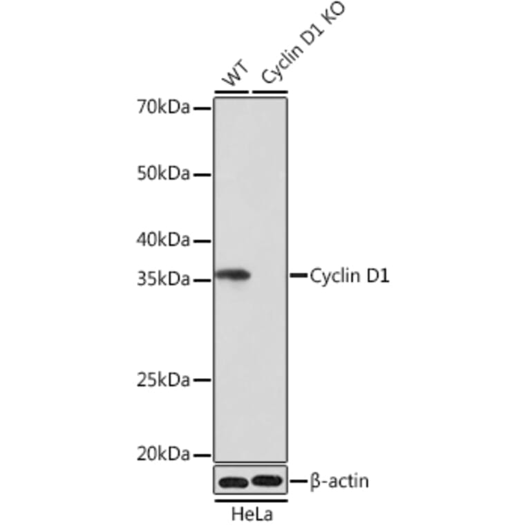 Western blot witb beta-Actin loading control - Anti-Cyclin D1 Antibody [ARC0300] (A306339) - Antibodies.com