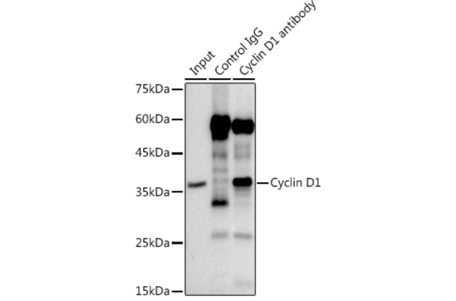 Western Blot - Anti-Cyclin D1 Antibody [ARC0300] (A306339) - Antibodies.com