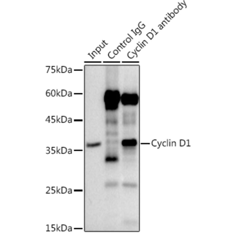 Western Blot - Anti-Cyclin D1 Antibody [ARC0300] (A306339) - Antibodies.com