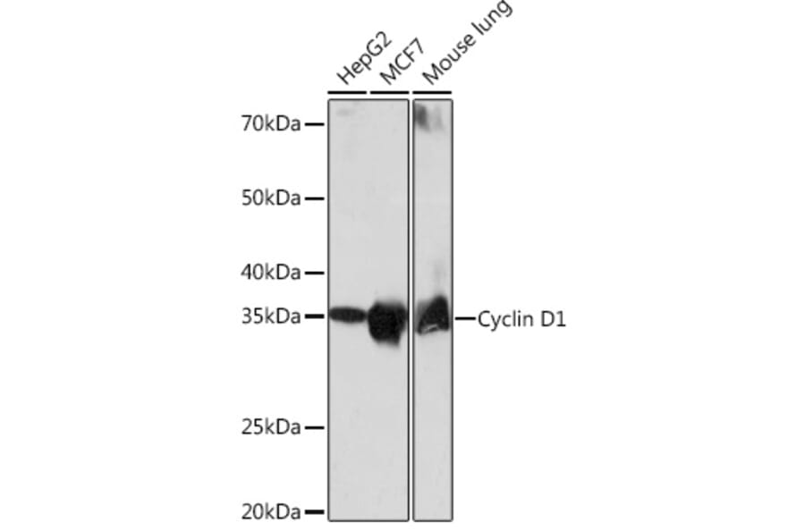 Western Blot - Anti-Cyclin D1 Antibody [ARC0300] (A306339) - Antibodies.com