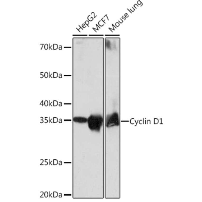 Western Blot - Anti-Cyclin D1 Antibody [ARC0300] (A306339) - Antibodies.com