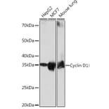 Western Blot - Anti-Cyclin D1 Antibody [ARC0300] (A306339) - Antibodies.com
