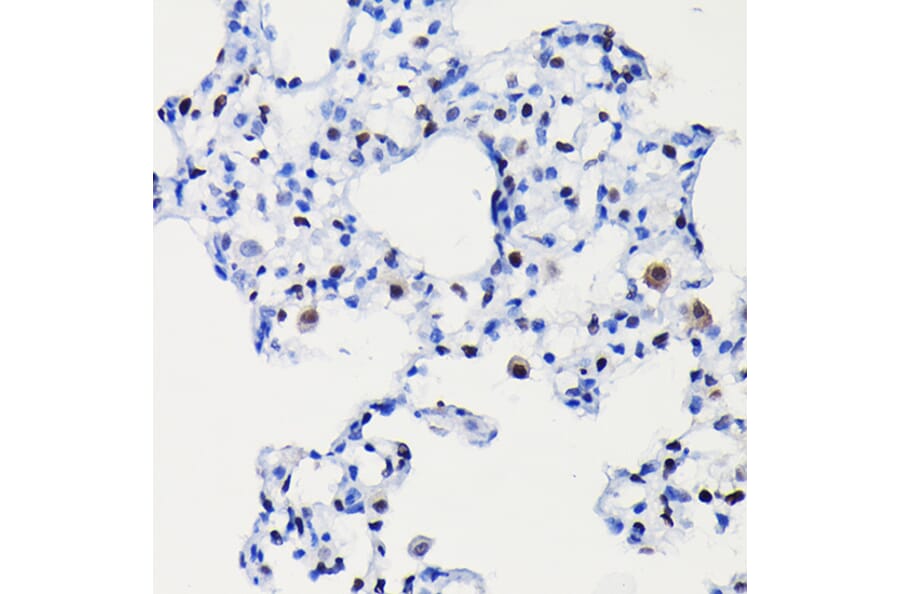 Immunohistochemistry - Anti-Cyclin D1 Antibody [ARC0300] (A306339) - Antibodies.com
