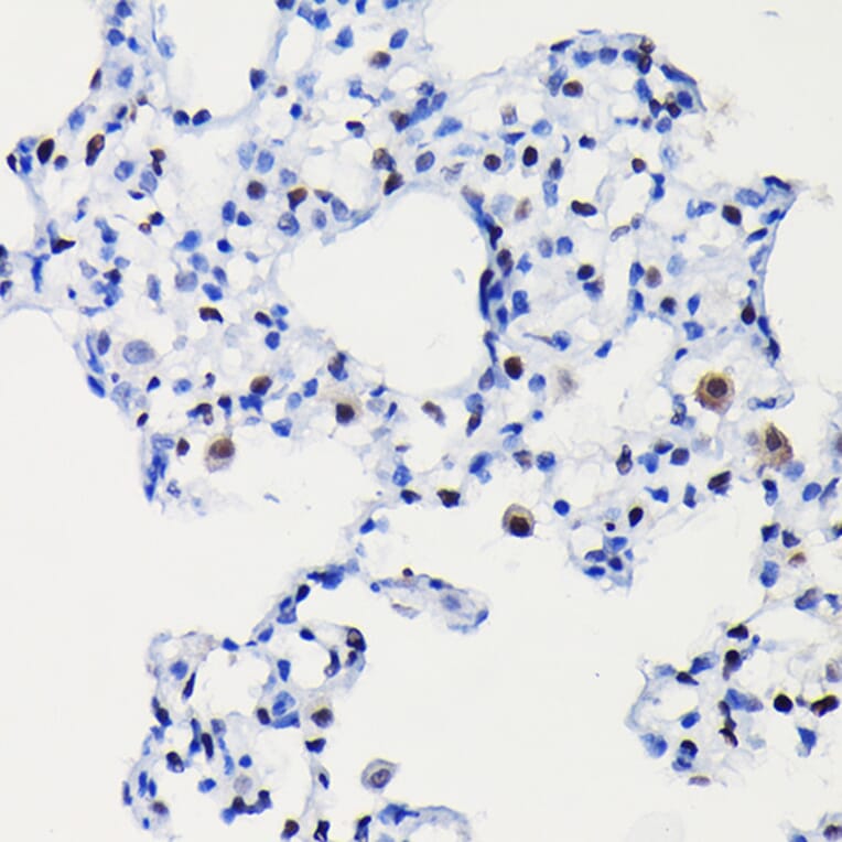 Immunohistochemistry - Anti-Cyclin D1 Antibody [ARC0300] (A306339) - Antibodies.com