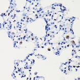 Immunohistochemistry - Anti-Cyclin D1 Antibody [ARC0300] (A306339) - Antibodies.com