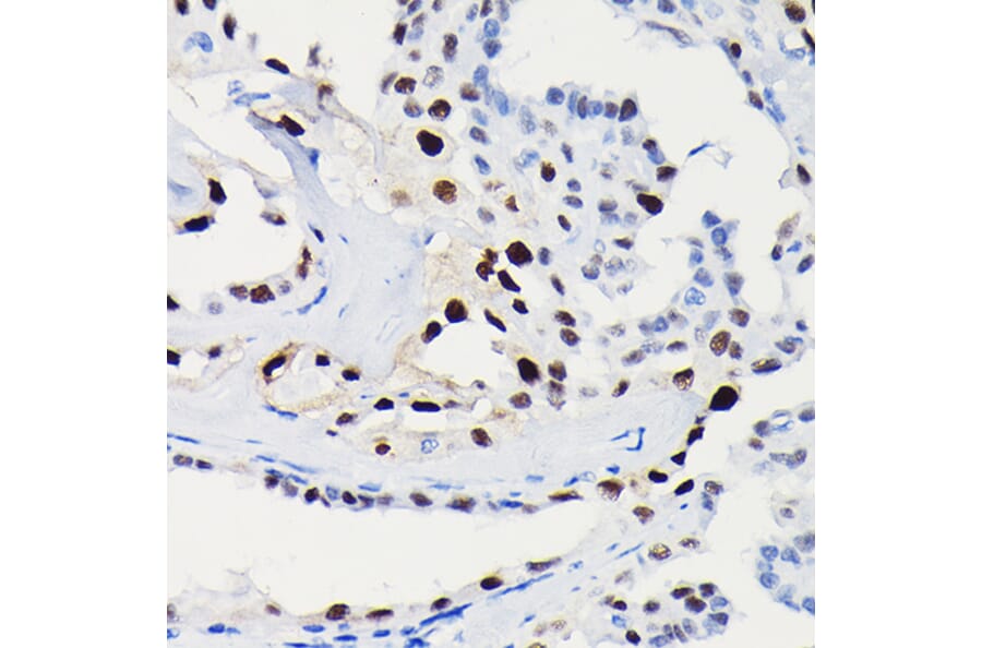 Immunohistochemistry - Anti-Cyclin D1 Antibody [ARC0300] (A306339) - Antibodies.com