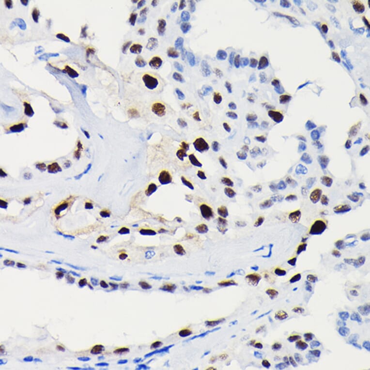 Immunohistochemistry - Anti-Cyclin D1 Antibody [ARC0300] (A306339) - Antibodies.com