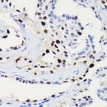 Immunohistochemistry - Anti-Cyclin D1 Antibody [ARC0300] (A306339) - Antibodies.com