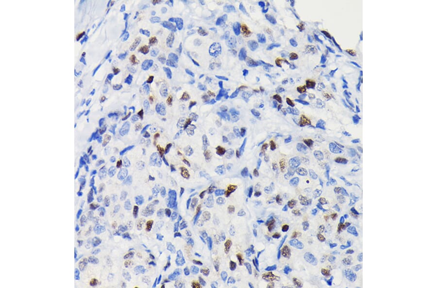 Immunohistochemistry - Anti-Cyclin D1 Antibody [ARC0300] (A306339) - Antibodies.com