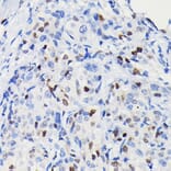 Immunohistochemistry - Anti-Cyclin D1 Antibody [ARC0300] (A306339) - Antibodies.com