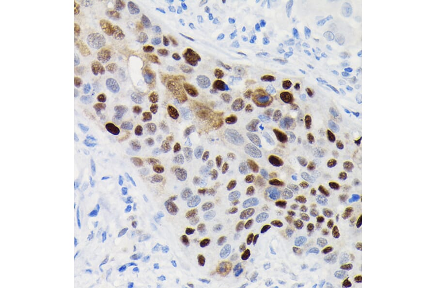Immunohistochemistry - Anti-Cyclin D1 Antibody [ARC0300] (A306339) - Antibodies.com