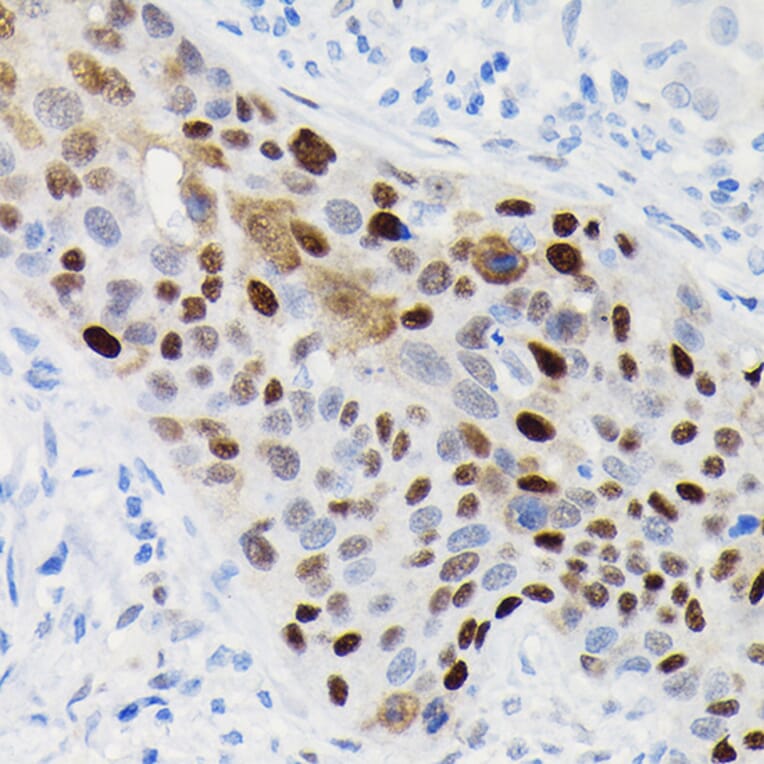 Immunohistochemistry - Anti-Cyclin D1 Antibody [ARC0300] (A306339) - Antibodies.com