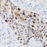 Immunohistochemistry - Anti-Cyclin D1 Antibody [ARC0300] (A306339) - Antibodies.com