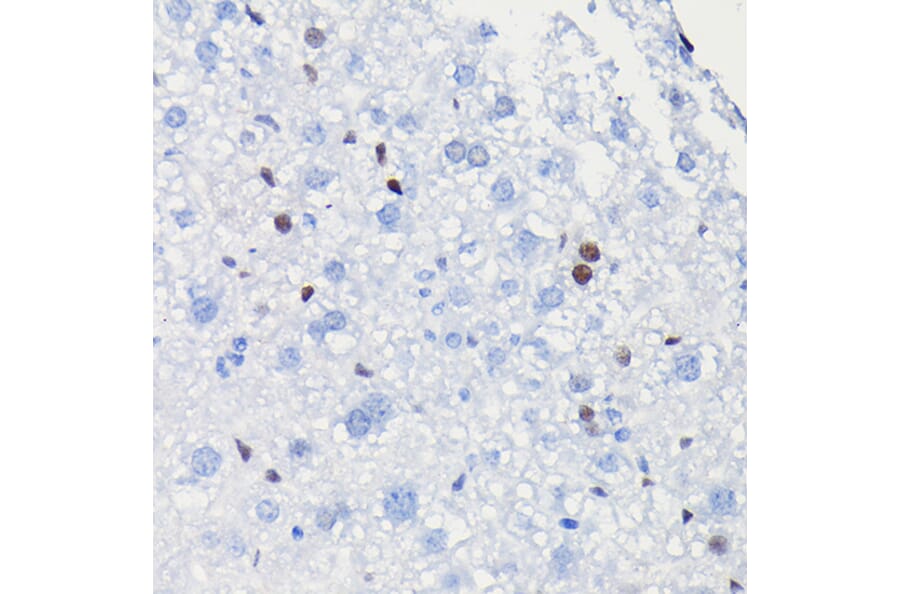 Immunohistochemistry - Anti-Cyclin D1 Antibody [ARC0300] (A306339) - Antibodies.com