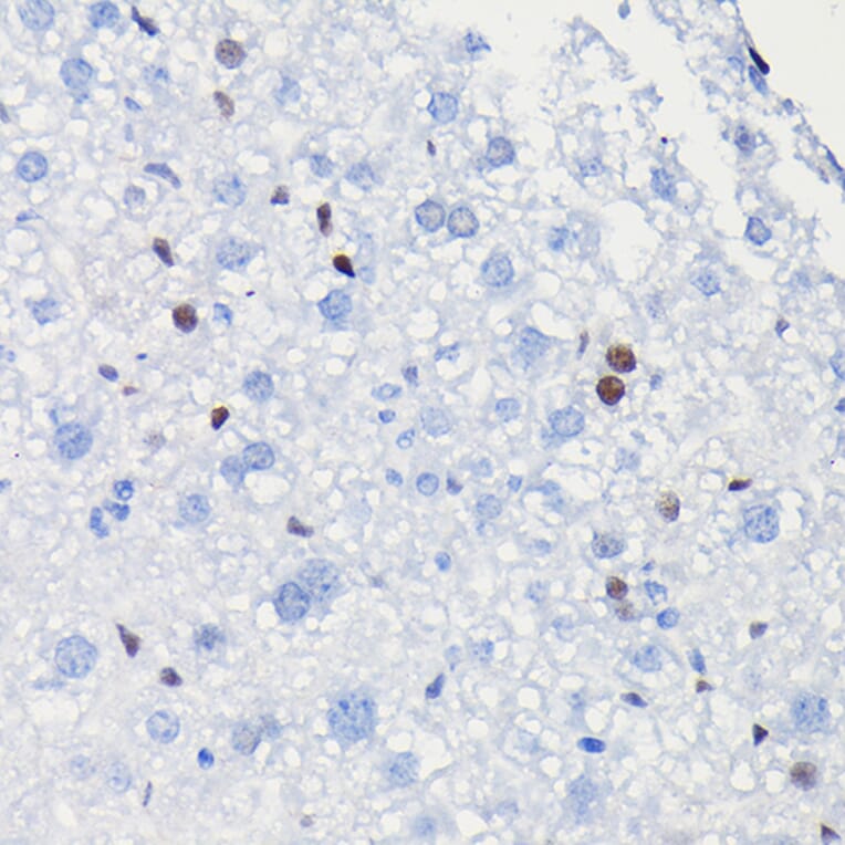 Immunohistochemistry - Anti-Cyclin D1 Antibody [ARC0300] (A306339) - Antibodies.com