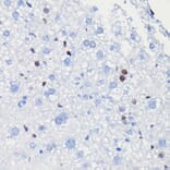Immunohistochemistry - Anti-Cyclin D1 Antibody [ARC0300] (A306339) - Antibodies.com