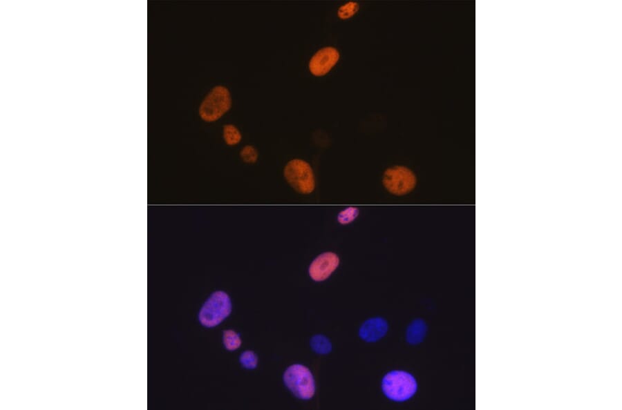 Immunofluorescence - Anti-Cyclin D1 Antibody [ARC0300] (A306339) - Antibodies.com