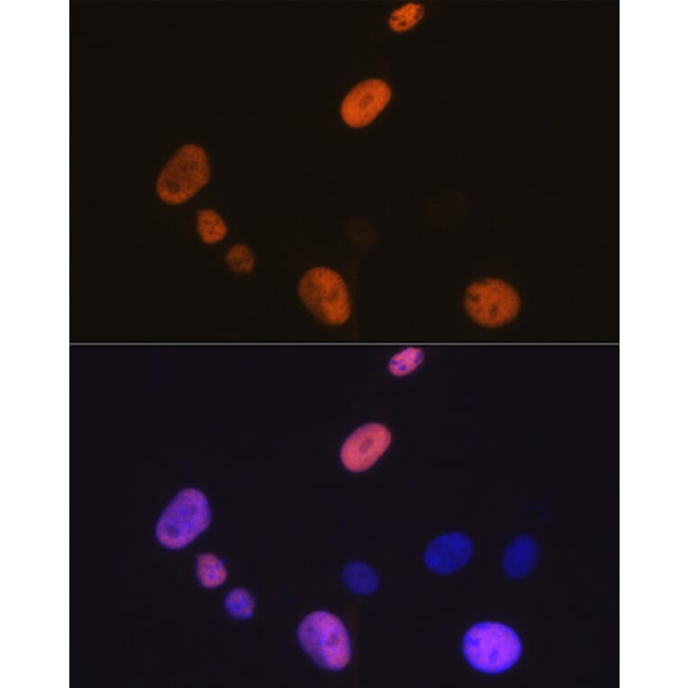 Immunofluorescence - Anti-Cyclin D1 Antibody [ARC0300] (A306339) - Antibodies.com