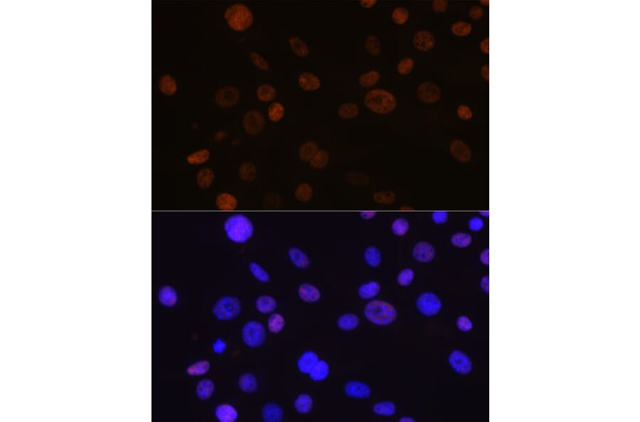Immunofluorescence - Anti-Cyclin D1 Antibody [ARC0300] (A306339) - Antibodies.com