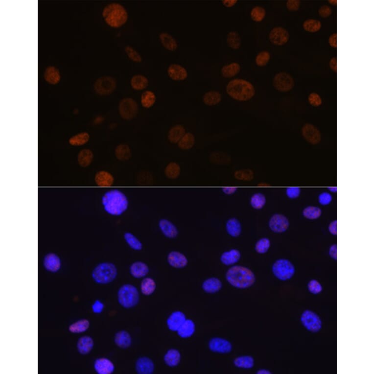 Immunofluorescence - Anti-Cyclin D1 Antibody [ARC0300] (A306339) - Antibodies.com