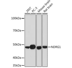 Western Blot - Anti-NDRG1 Antibody [ARC0887] (A306340) - Antibodies.com