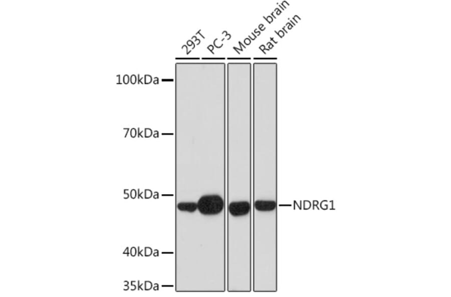 Western Blot - Anti-NDRG1 Antibody [ARC0887] (A306340) - Antibodies.com