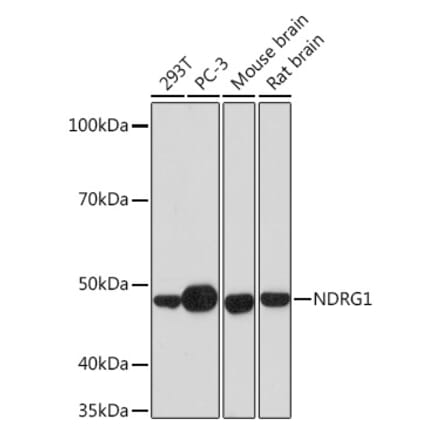 Western Blot - Anti-NDRG1 Antibody [ARC0887] (A306340) - Antibodies.com