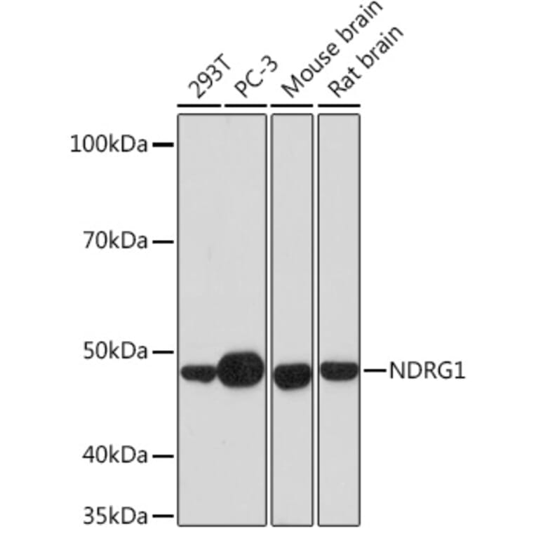 Western Blot - Anti-NDRG1 Antibody [ARC0887] (A306340) - Antibodies.com