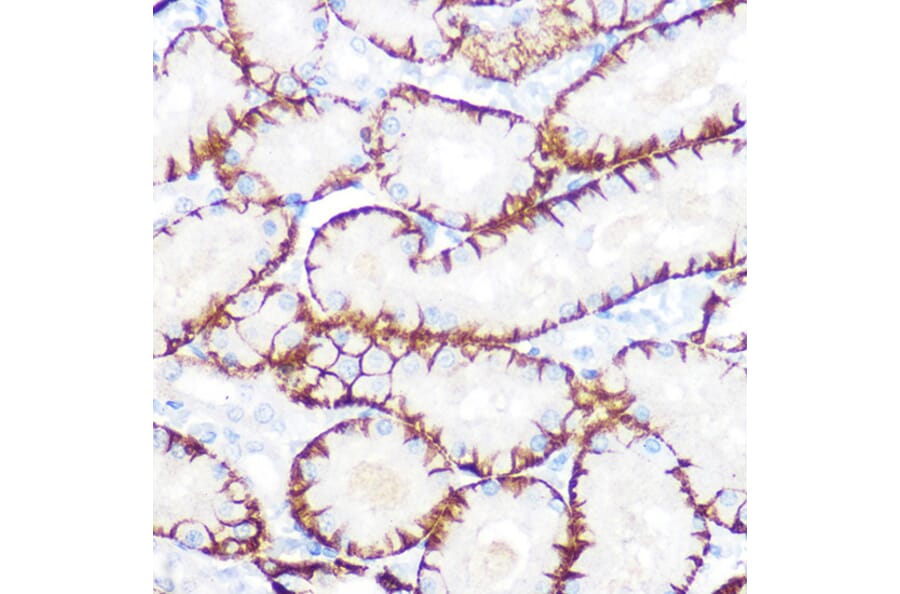 Immunohistochemistry - Anti-NDRG1 Antibody [ARC0887] (A306340) - Antibodies.com
