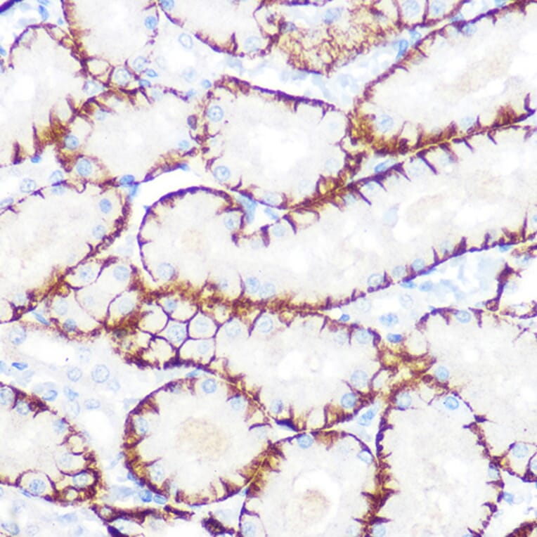 Immunohistochemistry - Anti-NDRG1 Antibody [ARC0887] (A306340) - Antibodies.com