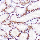 Immunohistochemistry - Anti-NDRG1 Antibody [ARC0887] (A306340) - Antibodies.com