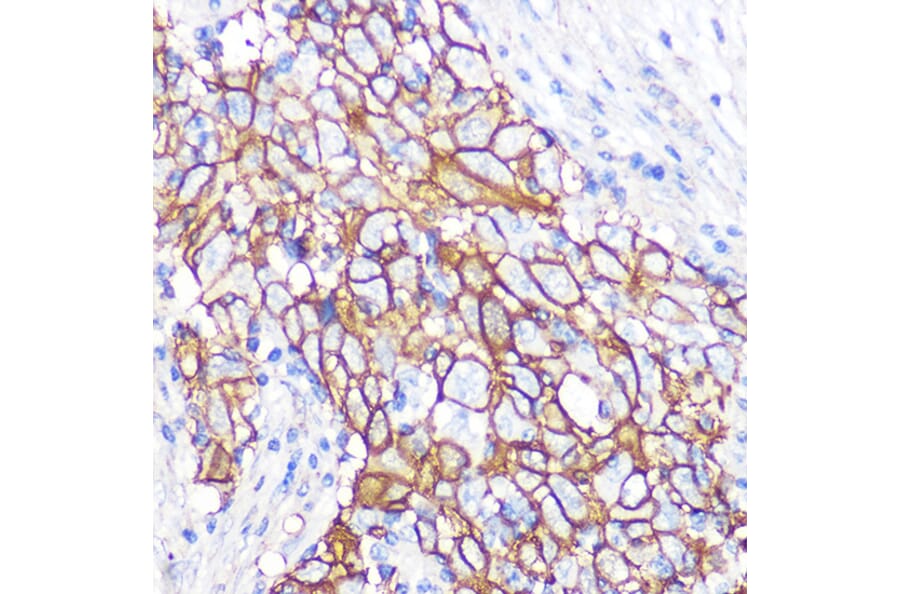 Immunohistochemistry - Anti-NDRG1 Antibody [ARC0887] (A306340) - Antibodies.com