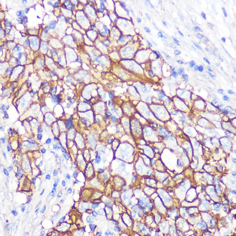 Immunohistochemistry - Anti-NDRG1 Antibody [ARC0887] (A306340) - Antibodies.com