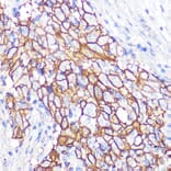 Immunohistochemistry - Anti-NDRG1 Antibody [ARC0887] (A306340) - Antibodies.com