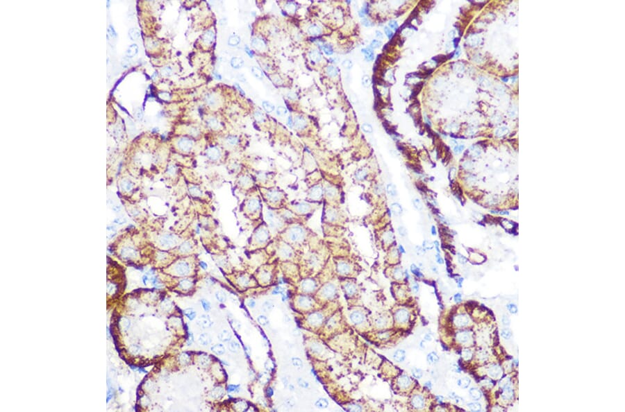Immunohistochemistry - Anti-NDRG1 Antibody [ARC0887] (A306340) - Antibodies.com