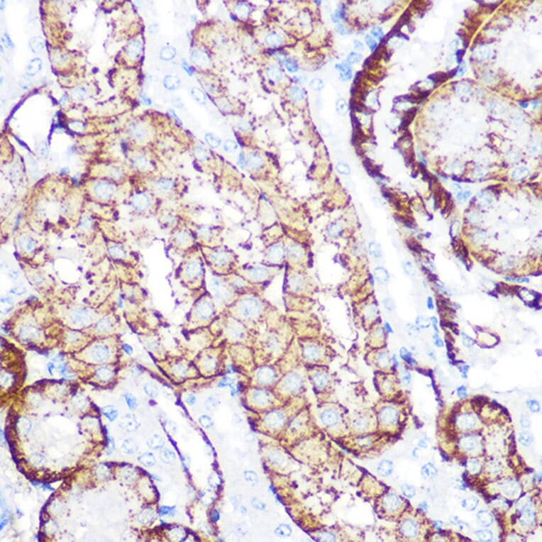 Immunohistochemistry - Anti-NDRG1 Antibody [ARC0887] (A306340) - Antibodies.com