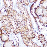 Immunohistochemistry - Anti-NDRG1 Antibody [ARC0887] (A306340) - Antibodies.com