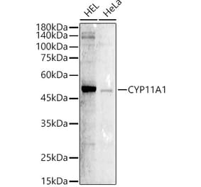 Western Blot - Anti-CYP11A1 Antibody (A306341) - Antibodies.com