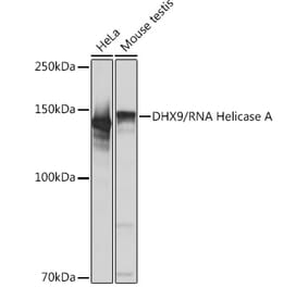 Western Blot - Anti-RNA Helicase A Antibody [ARC1033] (A306342) - Antibodies.com
