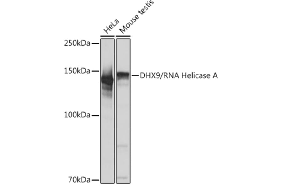 Western Blot - Anti-RNA Helicase A Antibody [ARC1033] (A306342) - Antibodies.com