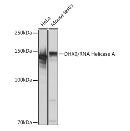 Western Blot - Anti-RNA Helicase A Antibody [ARC1033] (A306342) - Antibodies.com