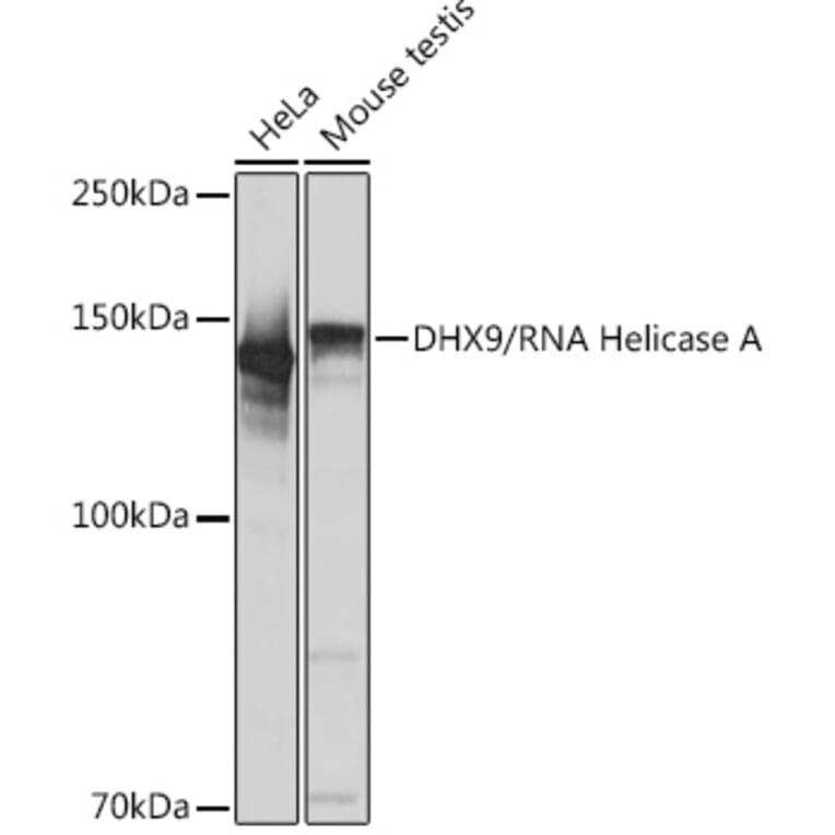 Western Blot - Anti-RNA Helicase A Antibody [ARC1033] (A306342) - Antibodies.com