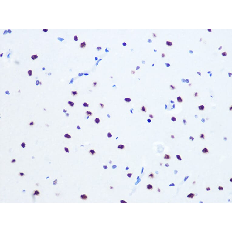 Immunohistochemistry - Anti-RNA Helicase A Antibody [ARC1033] (A306342) - Antibodies.com