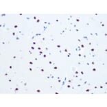 Immunohistochemistry - Anti-RNA Helicase A Antibody [ARC1033] (A306342) - Antibodies.com