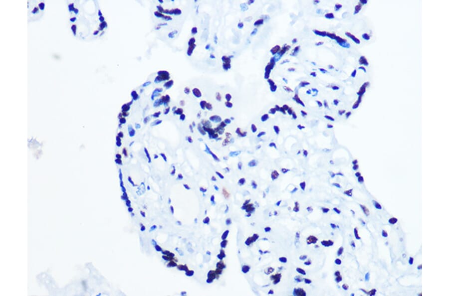 Immunohistochemistry - Anti-RNA Helicase A Antibody [ARC1033] (A306342) - Antibodies.com