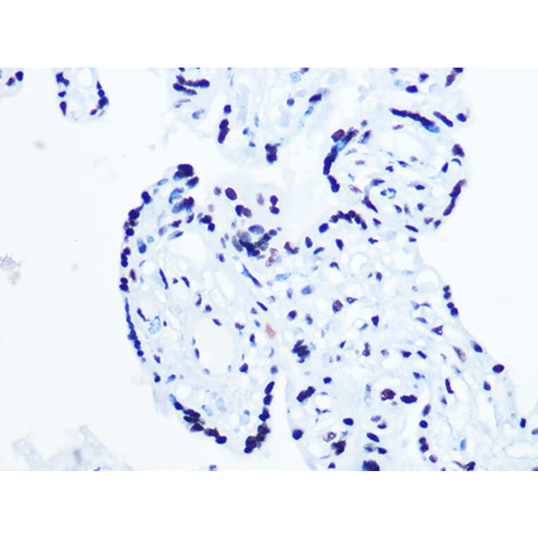 Immunohistochemistry - Anti-RNA Helicase A Antibody [ARC1033] (A306342) - Antibodies.com