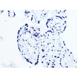 Immunohistochemistry - Anti-RNA Helicase A Antibody [ARC1033] (A306342) - Antibodies.com