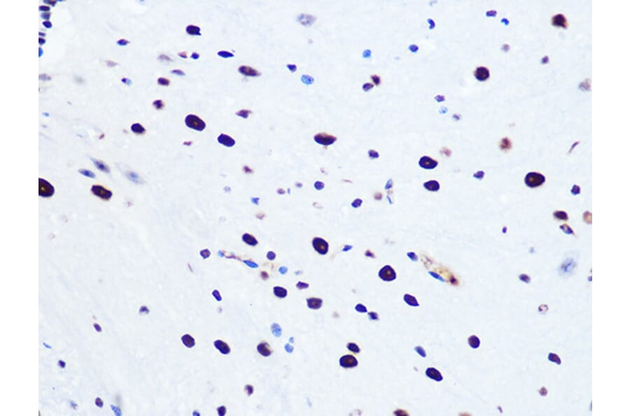 Immunohistochemistry - Anti-RNA Helicase A Antibody [ARC1033] (A306342) - Antibodies.com