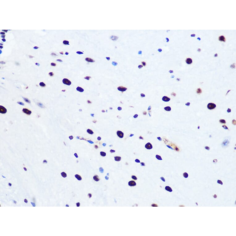 Immunohistochemistry - Anti-RNA Helicase A Antibody [ARC1033] (A306342) - Antibodies.com